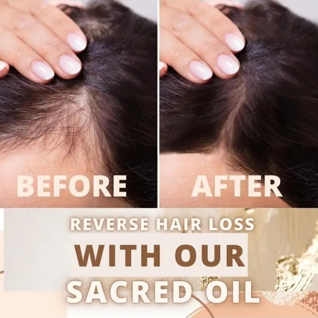 Batana Oil (Miracle Oil) 🪔