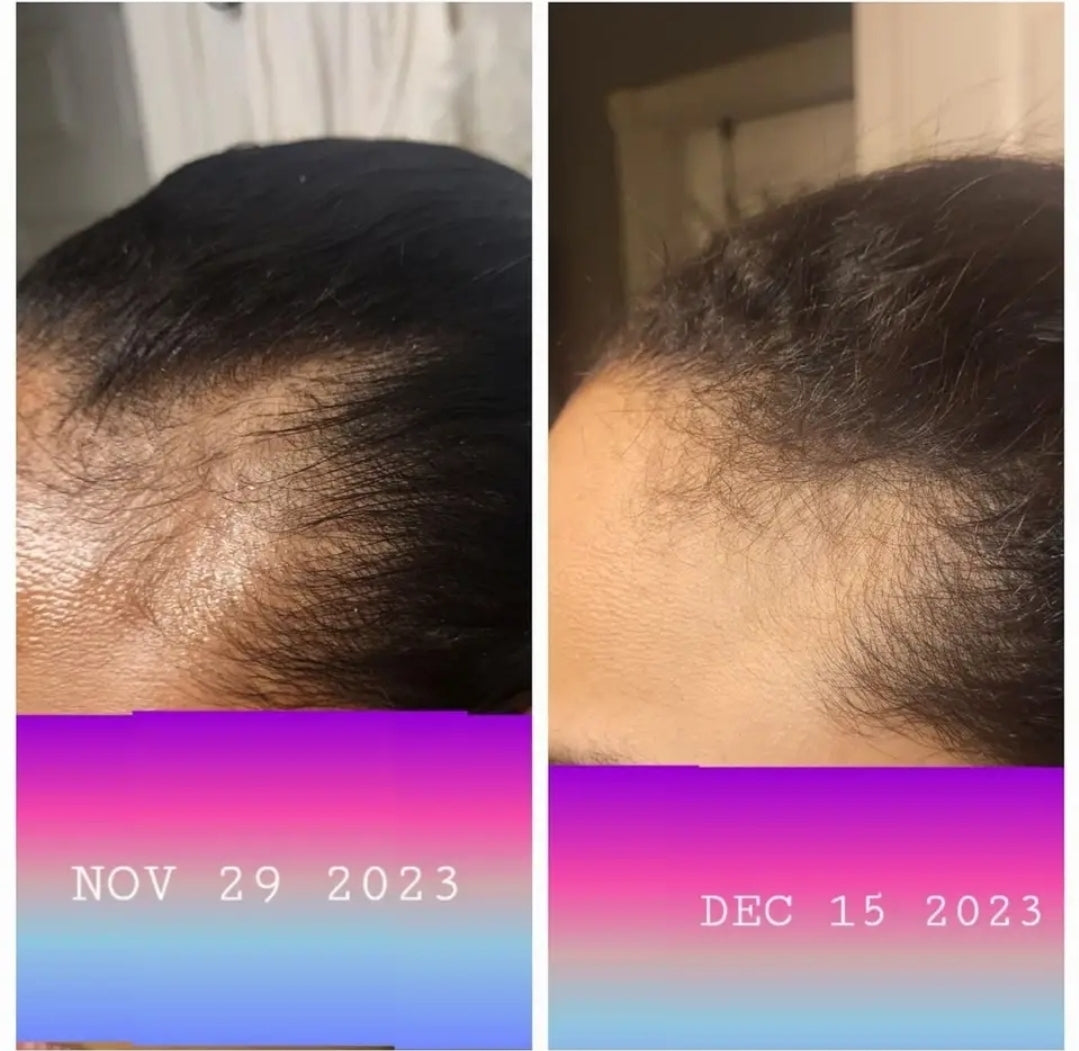 Batana Oil (Miracle Oil) 🪔