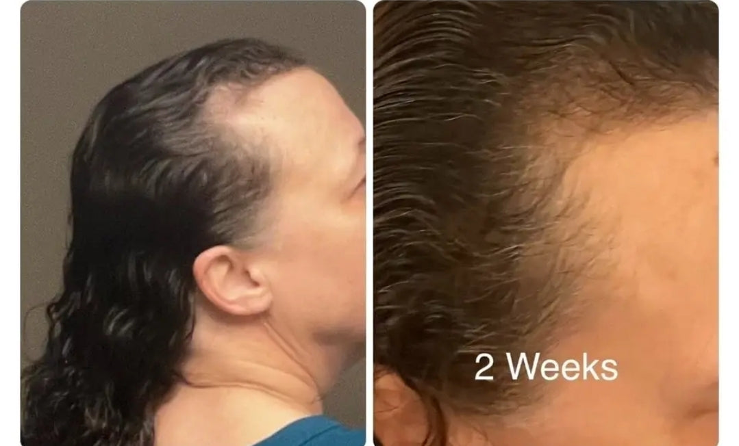 Batana Oil (Miracle Oil) 🪔